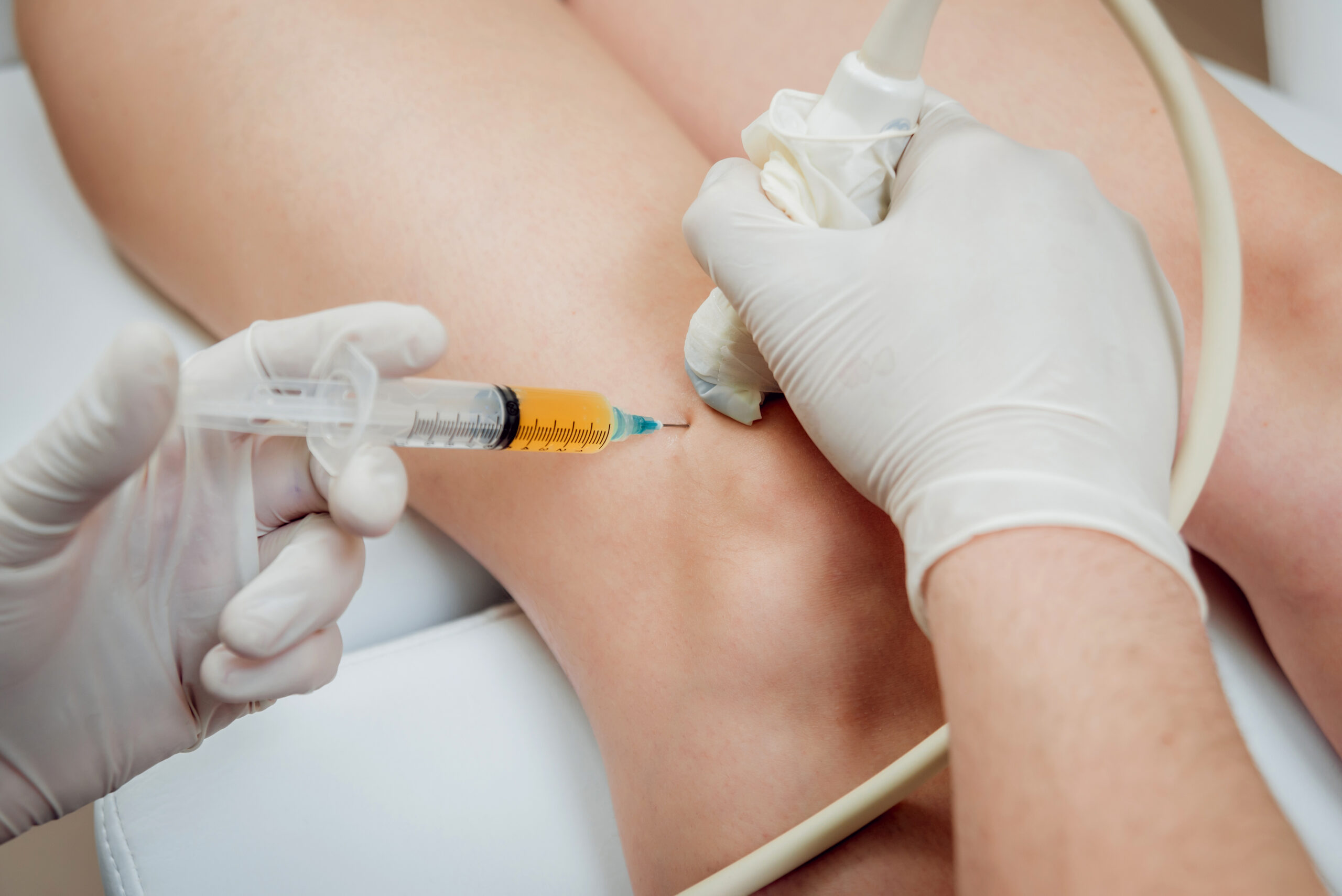 Platelet Rich Plasma PRP Injection